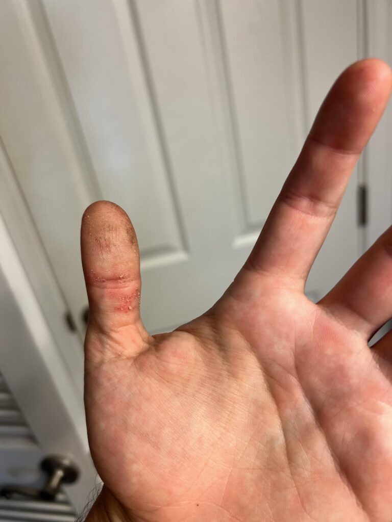 Bass Thumb